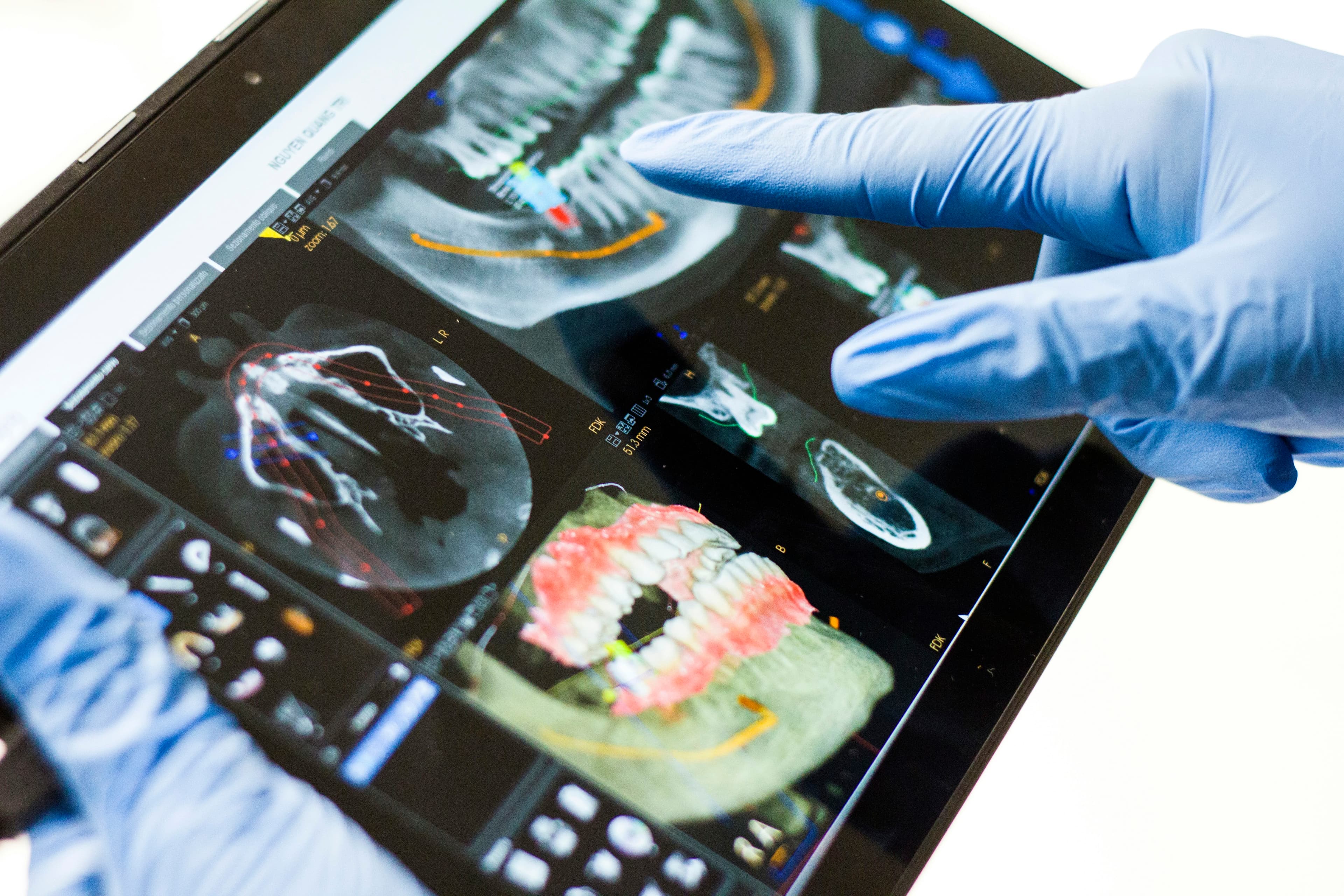 Digital Dentistry: The Future of Dental Care