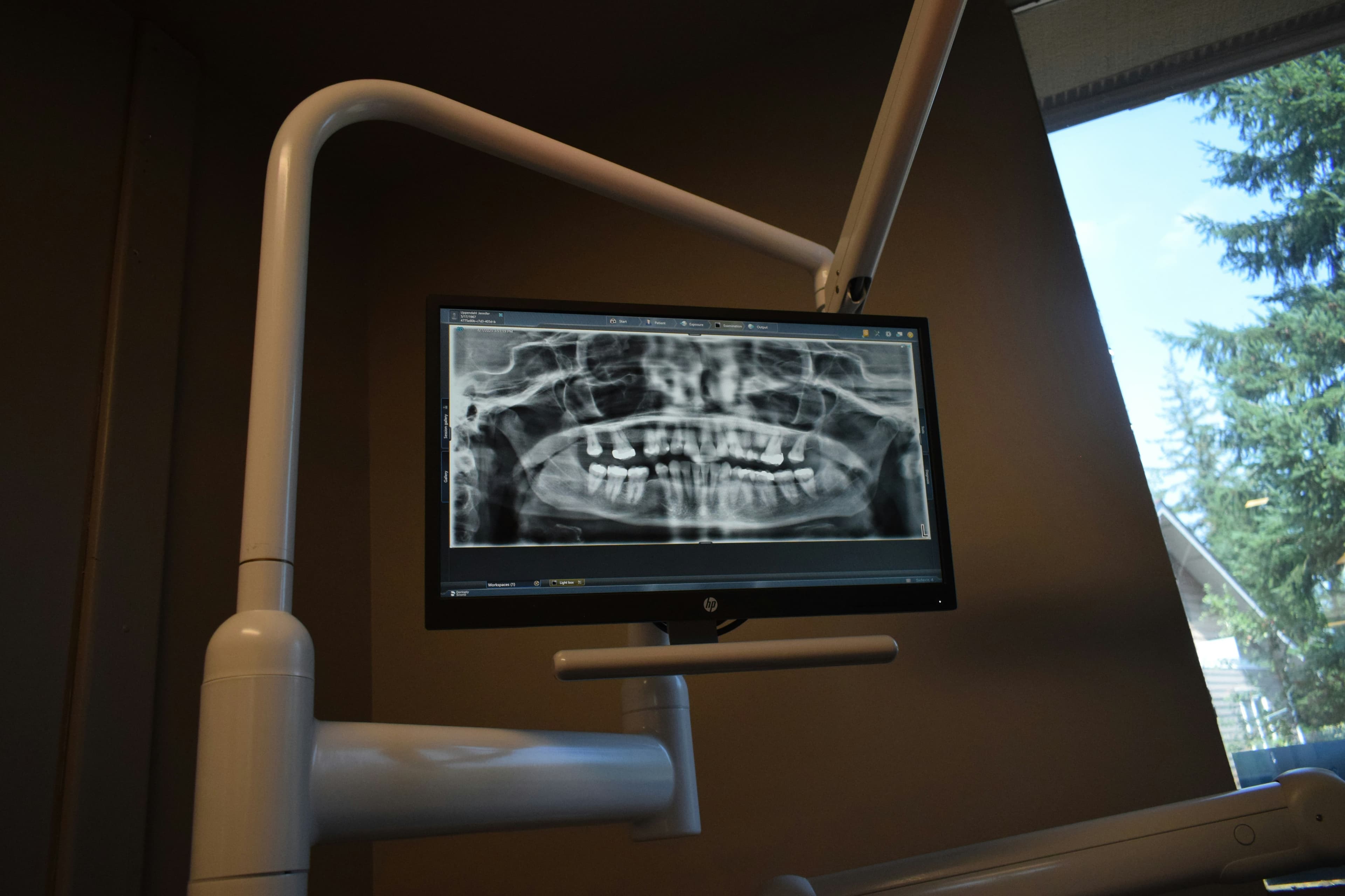 The Role of X-Ray Machines in Dental Diagnosis