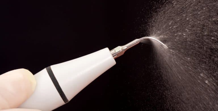 Benefits of Ultrasonic Scalers in Modern Dentistry